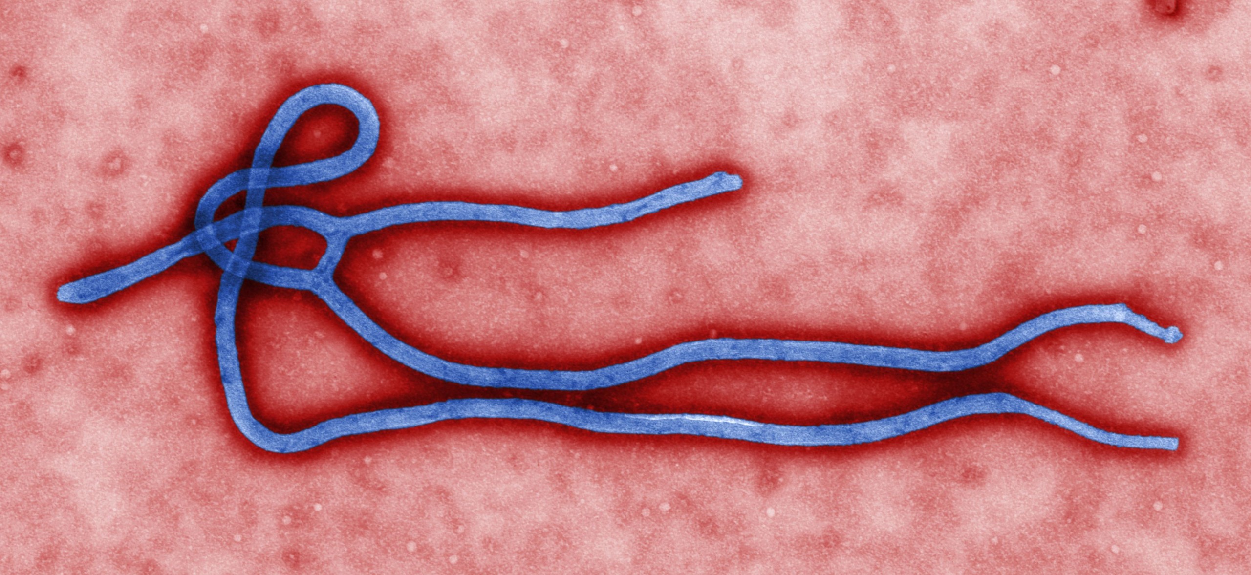 Electron micrograph of an Ebola virus virion (WikiCommons)