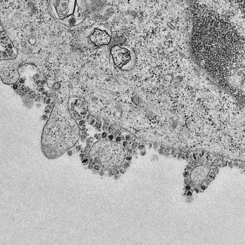 A microscope image of a cell infected with the novel coronavirus, grown in culture at the University of Hong Kong. Multiple virus particles are being released from the cell surface.Credit: John Nicholls, Leo Poon and Malik Peiris/The University of Hong Kong